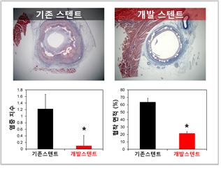 기존의 약물방출 스텐트와 비교하여, 수산화마그네슘 세라믹 나노입자를 포함한 개발 스텐트의 우수한 염증억제 효과와 현저히 낮은 재협착률을 보여주는 4주 돼지 동물실험 결과임.