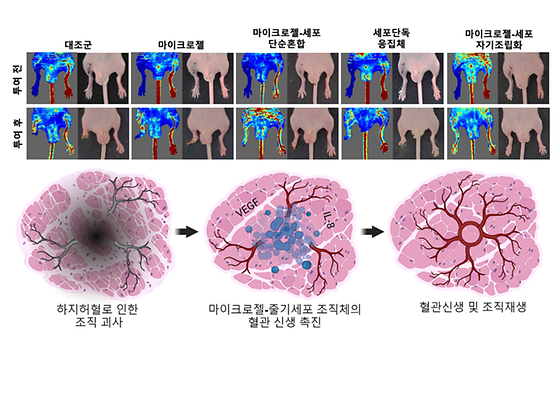 마이크로젤-세포 자기조립화 줄기세포치료제의 효능 검증