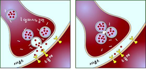 치매의 원인을 밝혀내다