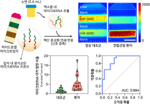 채혈 않고 1ml 안되는 소변으로 전립선암 진단 실마리